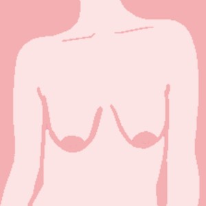 Slender breast shape